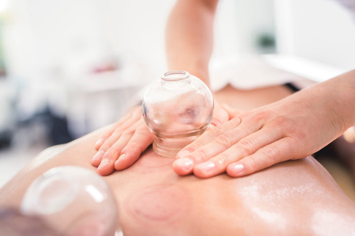 woman performing cupping massage